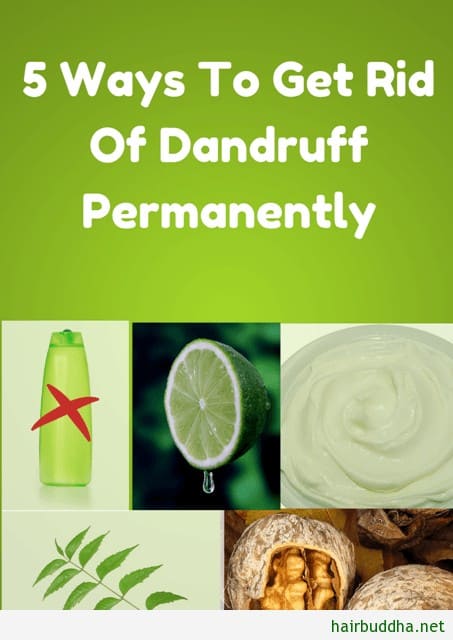 5 Ways To Get Rid Of Dandruff Permanently - hair buddha