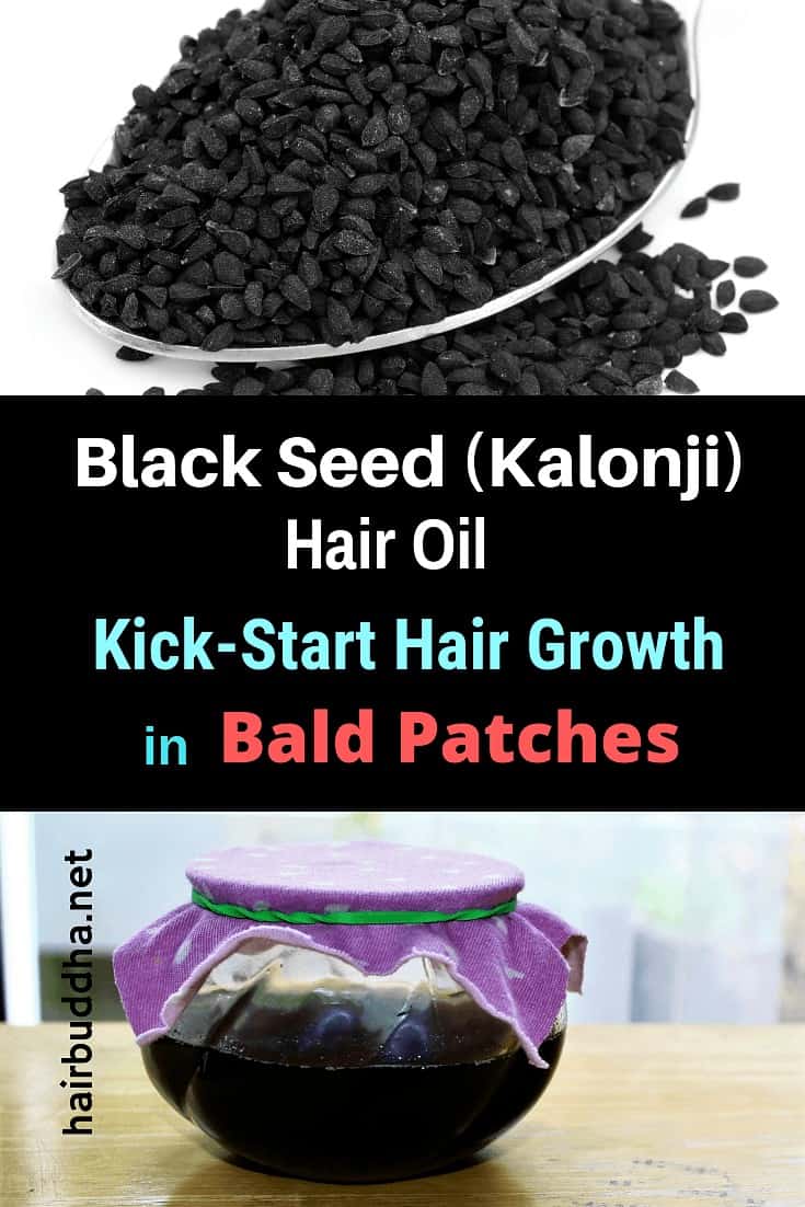 Black Seed (Kalonji) Hair Oil: Amazing Remedy for Bald Patches